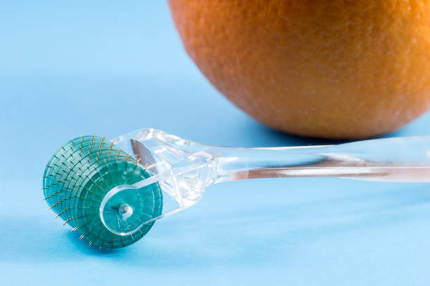istock Dermaroller for medical micro needling therapy 692230482
