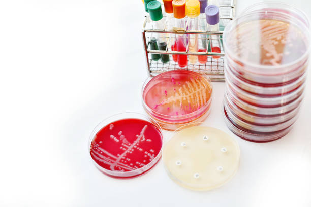 バクテリアの文化 - agar jelly medical sample bacterium microbiology ストックフォトと画像