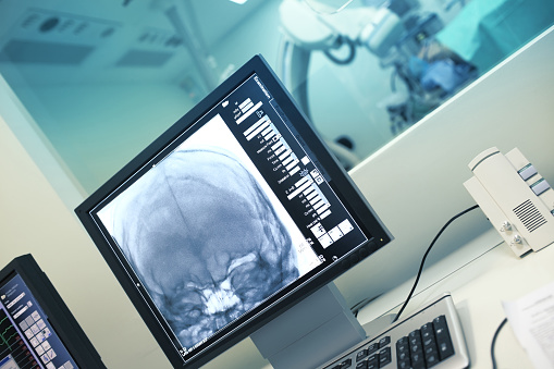 Examen de rayos x de cabeza en el monitor photo