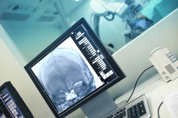 Photo of X-ray examination of head on the monitor