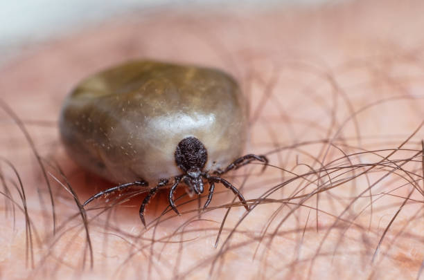 istock Tick filled with blood sitting on human skin 692502522