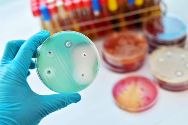 항균 감수성 검사 - petri dish 이미지 뉴스 사진 이미지