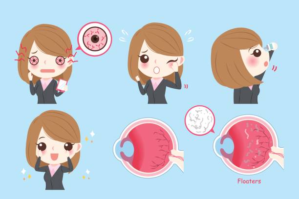 illustrations, cliparts, dessins animés et icônes de femme d’affaires avec problème oculaire - choroid