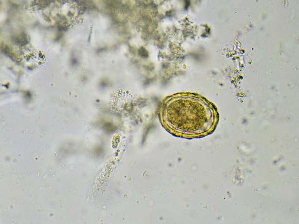 istock Ascaris lumbricoides 692962714