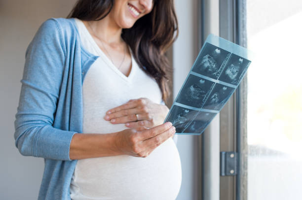 pregnant woman holding ultrasound - abdomen women loving human hand imagens e fotografias de stock