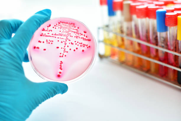 バクテリアの文化 - agar jelly medical sample bacterium microbiology ストックフォトと画像