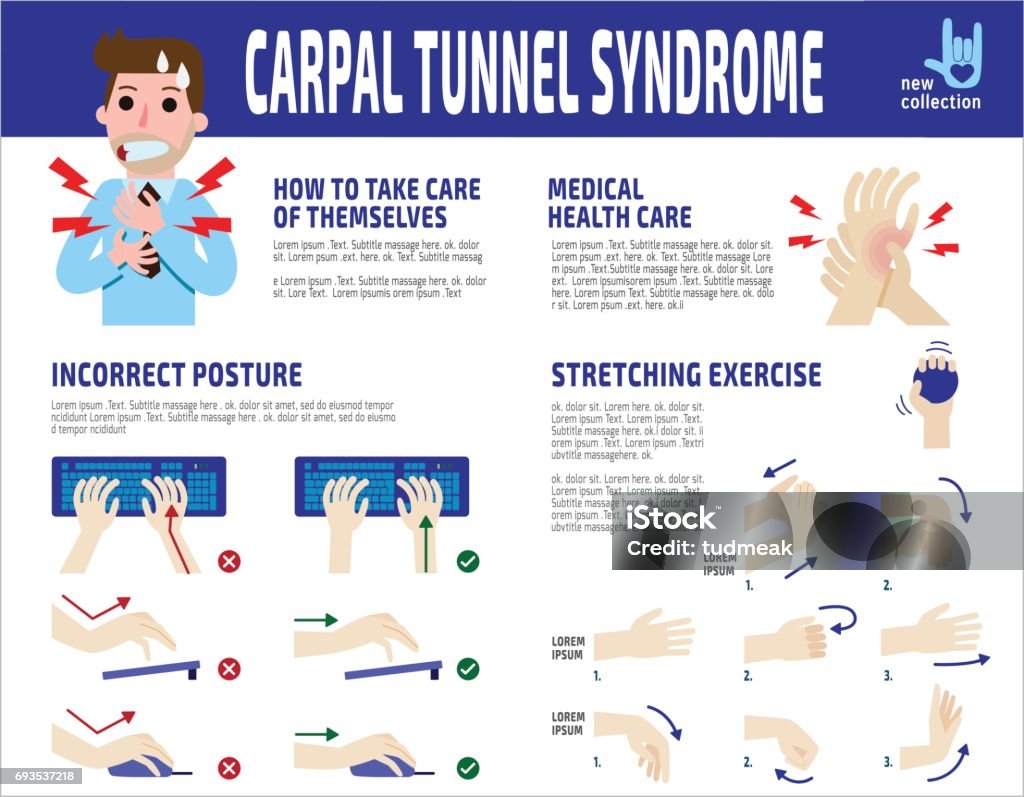 Karpaltunnel-Syndrom Infografik, Geschäftsmann. Geschäftsmann Schmerzen am Handgelenk. Health care Konzept. Flache Cartoon Charakter Symbol Design Vektorgrafik - Lizenzfrei Dehnen Vektorgrafik