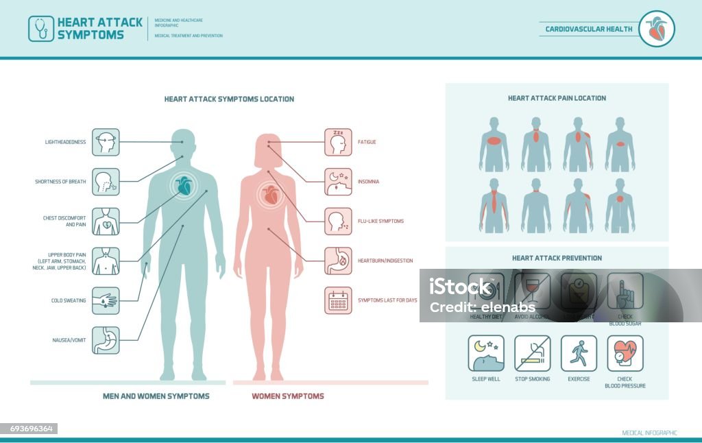 Herzinfarkt-Anzeichen und Warnungen - Lizenzfrei Herzinfarkt Vektorgrafik