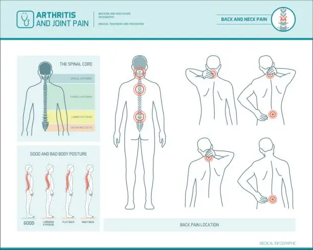 Vector illustration of Back pain infographic