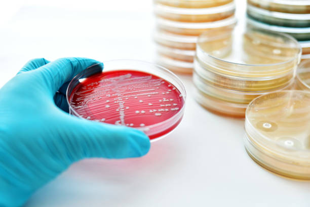 バクテリアの文化 - agar jelly medical sample bacterium microbiology ストック��フォトと画像