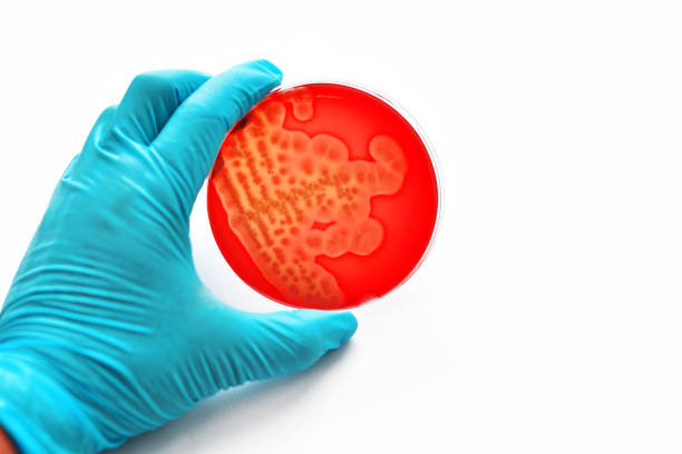 バクテリアの文化 - agar jelly medical sample bacterium microbiology ストックフォトと画像