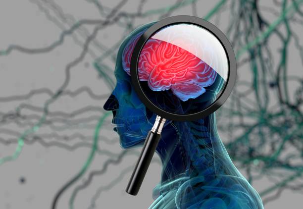 3d medicinsk bakgrund med förstoringsglas att undersöka hjärnan föreställande alzheimers forskning. 3d illustration - demens bildbanksfoton och bilder
