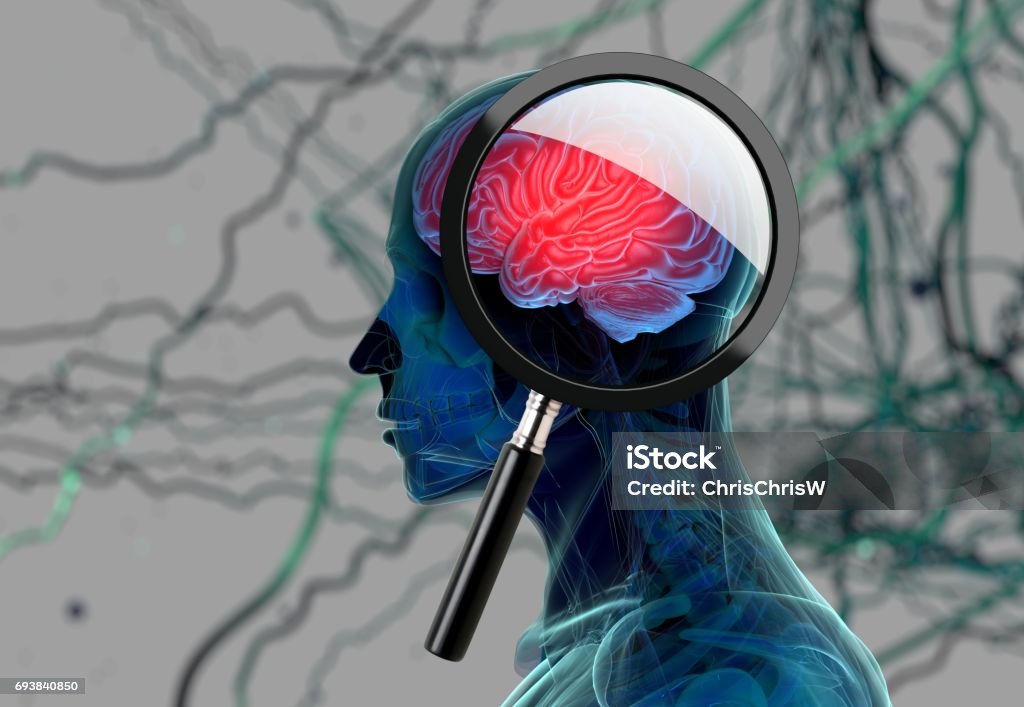 Alzheimer Araştırma tasvir eden beyin inceleyerek büyüteç ile 3D tıbbi geçmişi. 3D çizim - Royalty-free Bunama hastalığı Stok görsel