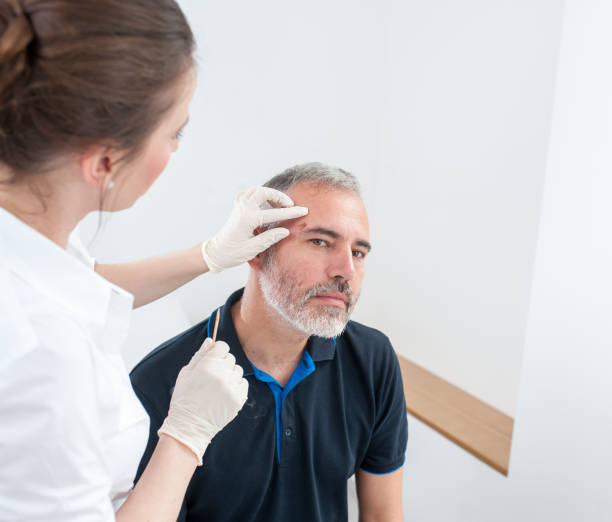 istock Chryotherapy used to Removed an Aged Spot 693844142