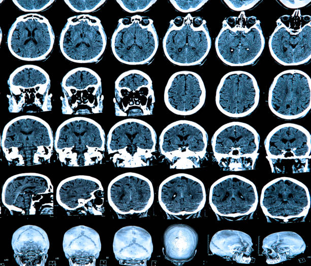 cerebro humano - phase image mri scan science nobody fotografías e imágenes de stock