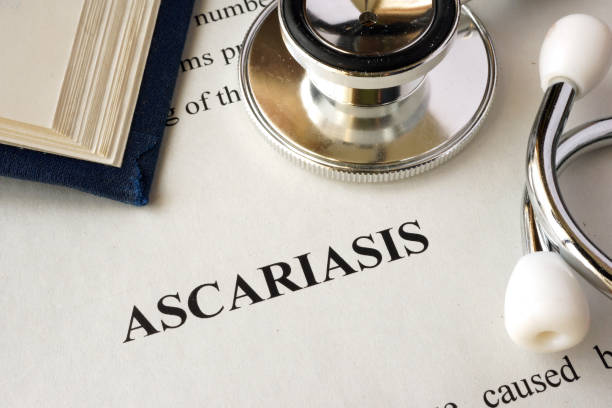 istock Document with word Ascariasis in a hospital. 694122324