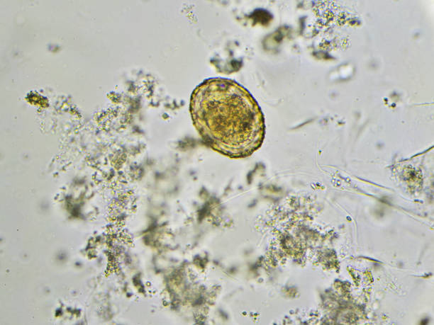 istock Ascaris lumbricoides 694177998