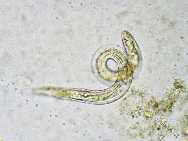 istock Strongyloides stercoralis (threadworm) 694181148