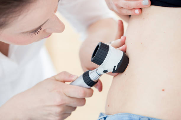 istock Dermatologist Inspecting Patient Skin Moles with Dermatoscope 694181862