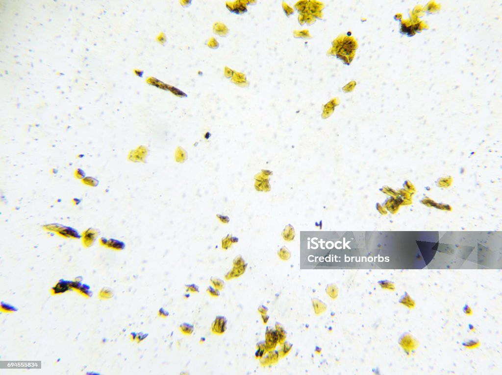 Microscopic image of human cheek cells dyed yellow human cheek cells under microscope Bacterium Stock Photo
