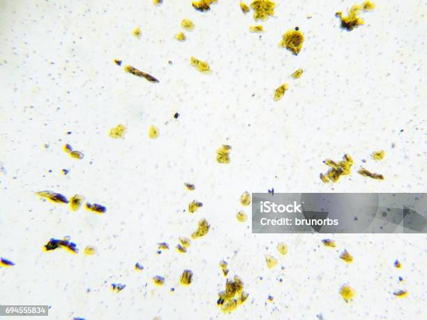 Microscopic Image Of Human Cheek Cells Dyed Yellow Stock Photo - Download Image Now - Bacterium, Biological Cell, Biopsy