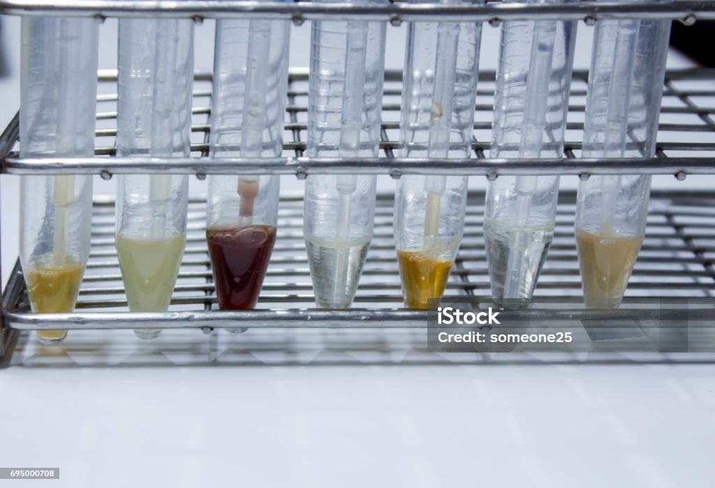Urrine Sample Urine Sample Stock Photo - Download Image Now - Adult, Analyzing ...