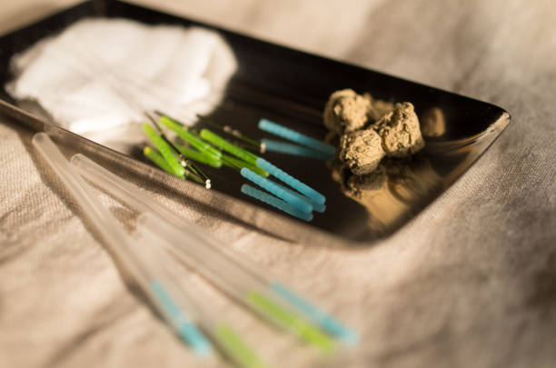 Image photo of acupuncture.