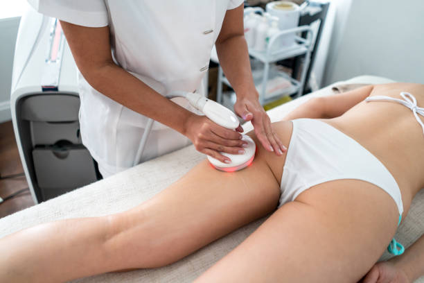 Woman getting laser treatment at the spa Woman at the spa getting laser treatment for her cellulite - beauty concepts cellulite stock pictures, royalty-free photos & images