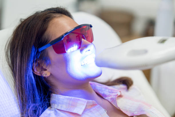 Woman getting laser teeth whitening Beautiful woman getting laser teeth whitening - oral healthcare concepts tooth whitening photos stock pictures, royalty-free photos & images