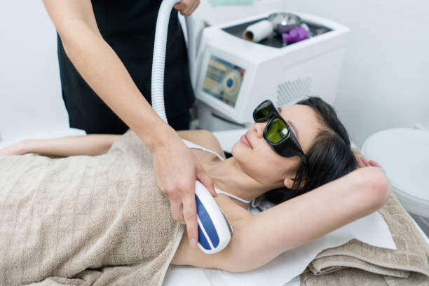 woman at the spa getting laser hair removal - waxing armpit women beauty treatment imagens e fotografias de stock