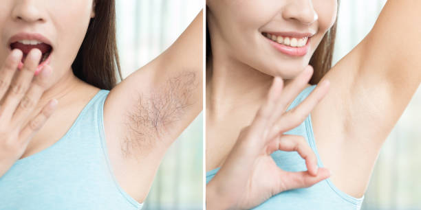 woman with armpit plucking - waxing armpit women beauty treatment imagens e fotografias de stock