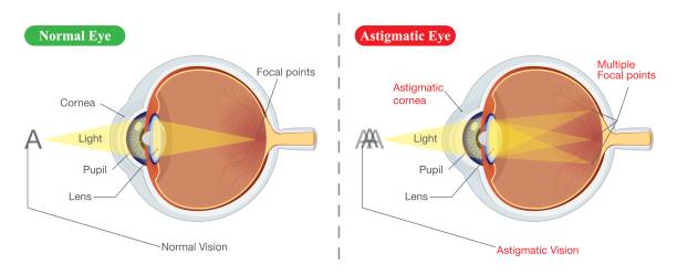 ilustrações de stock, clip art, desenhos animados e ícones de vision of normal eye and astigmatic - sensory perception eyeball human eye eyesight