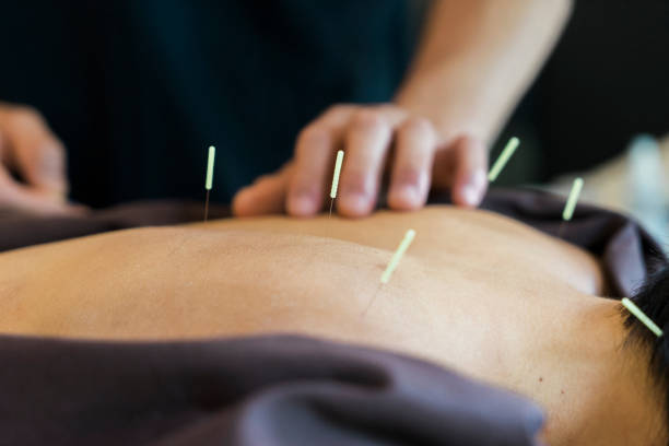 istock Alternative therapy with acupuncture in a clinic 695600842