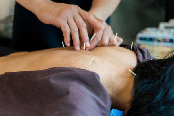 istock Alternative therapy with acupuncture in a clinic 695600892