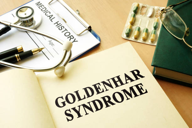 istock Book with title Goldenhar Syndrome on a table. 695603660