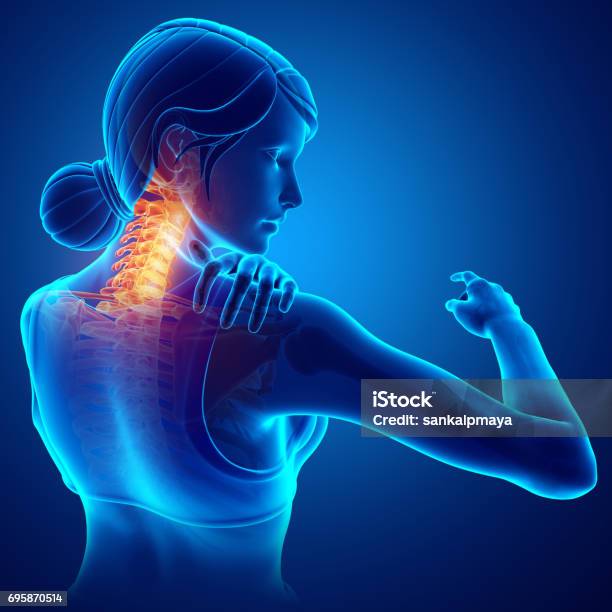 Women Feeling The Neck Pain Stock Photo - Download Image Now - Orthopedics, Neckache, Anatomy