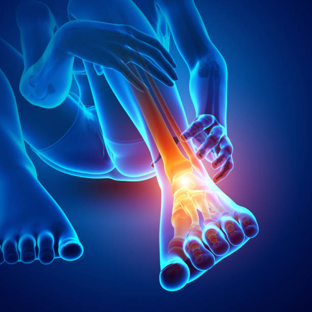 istock Male foot with ankle pain 695904838
