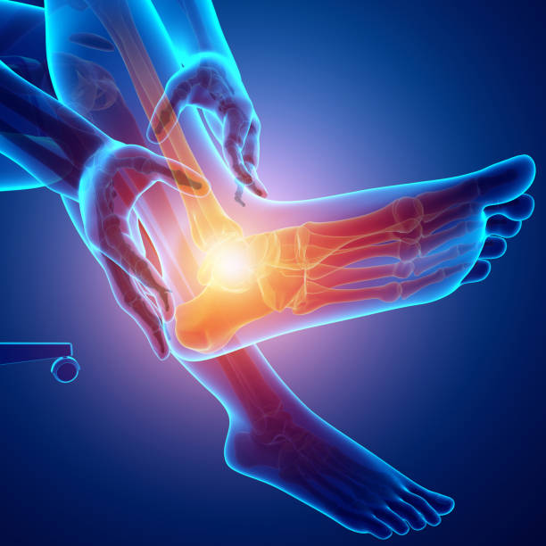 istock Male foot with ankle pain 695910132