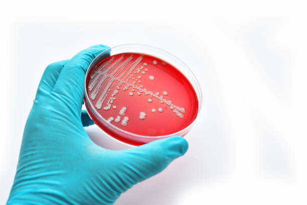 バクテリアの文化 - agar jelly medical sample bacterium microbiology ストックフォトと画像