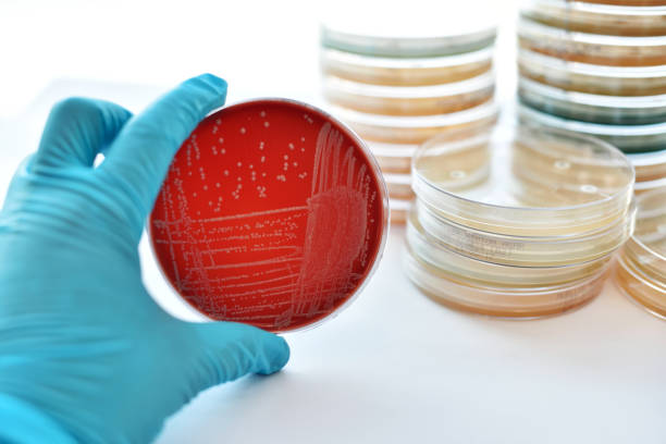 バクテリアの文化 - agar jelly medical sample bacterium microbiology ストックフォトと画像