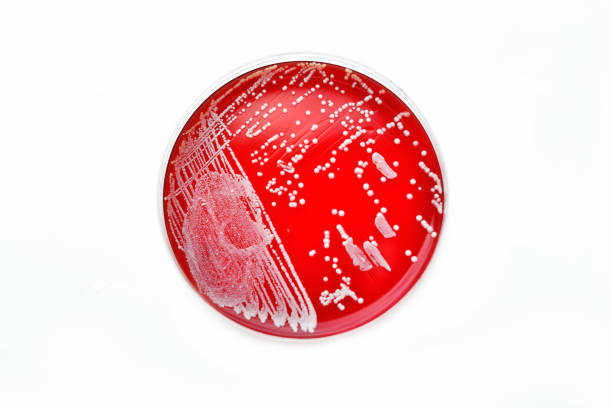 バクテリアの文化 - agar jelly medical sample bacterium microbiology ストックフォトと画像