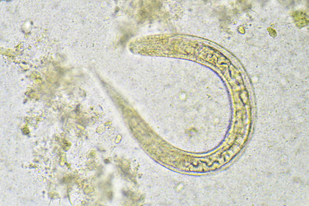 istock Strongyloides stercoralis (threadworm) 696009474