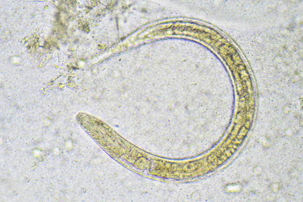 istock Strongyloides stercoralis (threadworm) 696009588