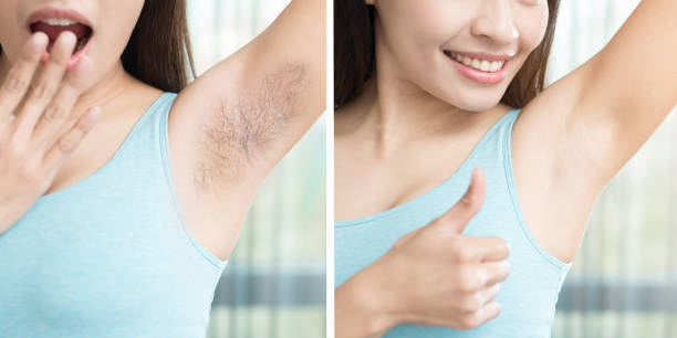 istock woman with body odor 696117250