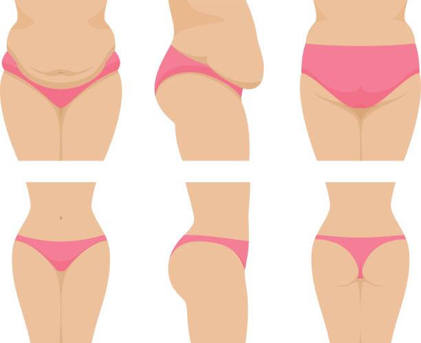 Vector set female waist before after losing weight Vector illustration of a set of female waist before and after losing weight. Isolated white background. Flat style. Front, side and rear view. Flabby fat belly and ass. slim woman body stock illustrations