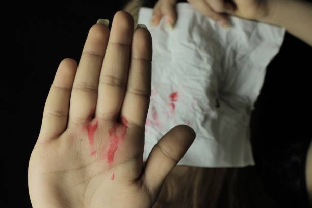istock Ayoung women is hurt from violence 696608348