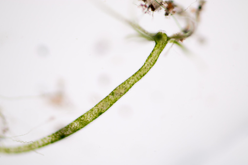 Hydra is a genus of small, fresh-water animals of the phylum Cnidaria and class Hydrozoa under the microscope for education.