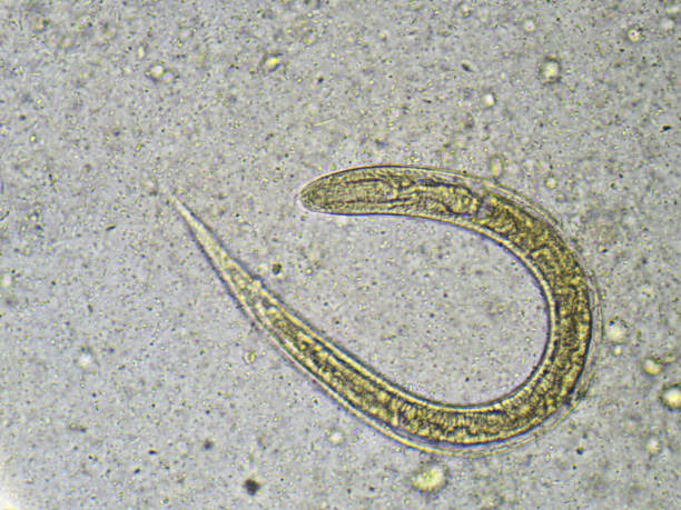 istock Strongyloides stercoralis (threadworm) 696689352