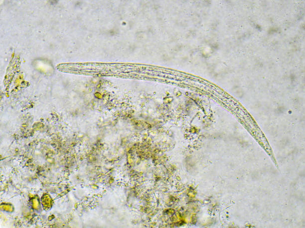 istock Strongyloides stercoralis (threadworm) 696690022