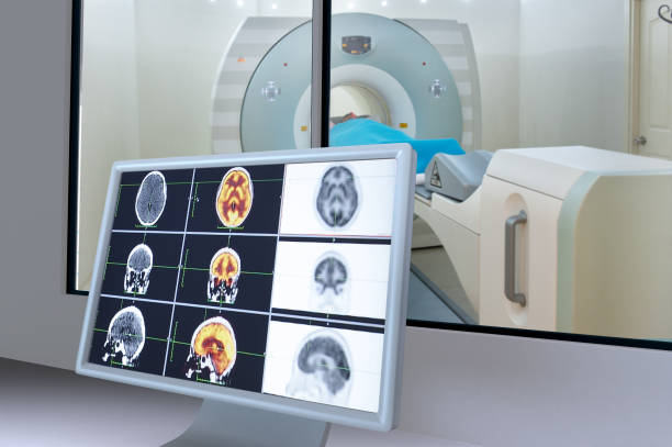 Medical scan monitor Medical scan monitor pet scan photos stock pictures, royalty-free photos & images